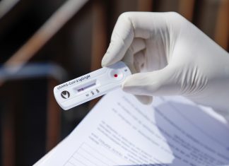 Descontos em testes de Covid-19 antes da viagem Gol fecha parceria para realização dos testes. Foto: Divulgação