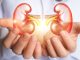 Verão x saúde renal: saiba mais Pouca ingestão de líquido e sal em excesso aumentam a incidência em até 20% nesta época do ano. Foto: Divulgação