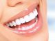 Higiene bucal evita problemas de saúde Doenças periodontais sem tratamento aumentam os riscos de infarto e AVC. Foto: Divulgação