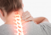Por que problemas na coluna afetam braços e pernas? Entenda e saiba como se prevenir estes problemas. Foto: Divulgação