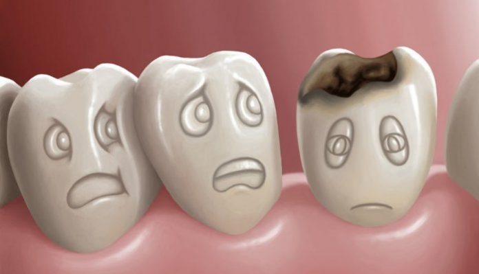 Cirurgiã-dentista fala sobre os impactos de medicamentos na boca e como fugir de possíveis problemas odontológicos. Foto: Divulgação