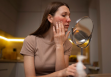 Mês de abril tem foco na rosácea, que pede abordagem personalizada para evitar impactos na qualidade de vida