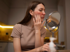 Mês de abril tem foco na rosácea, que pede abordagem personalizada para evitar impactos na qualidade de vida