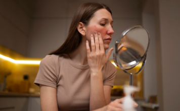 Mês de abril tem foco na rosácea, que pede abordagem personalizada para evitar impactos na qualidade de vida